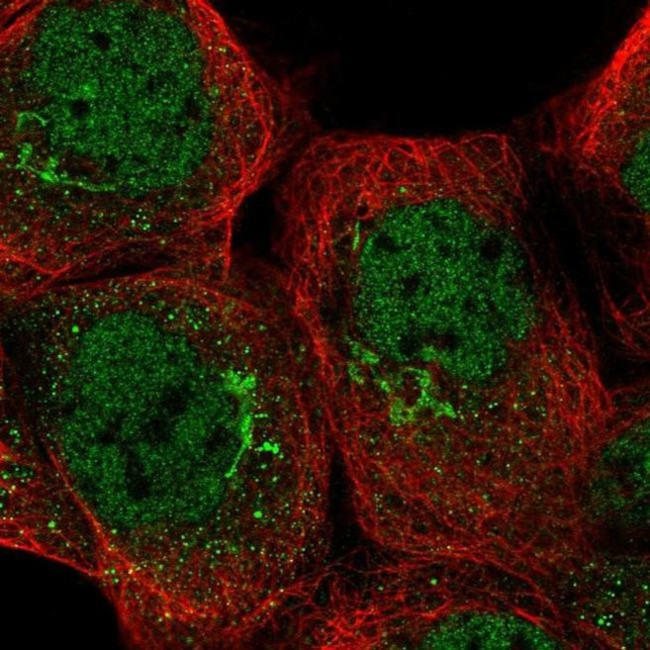 TRRAP Antibody in Immunocytochemistry (ICC/IF)