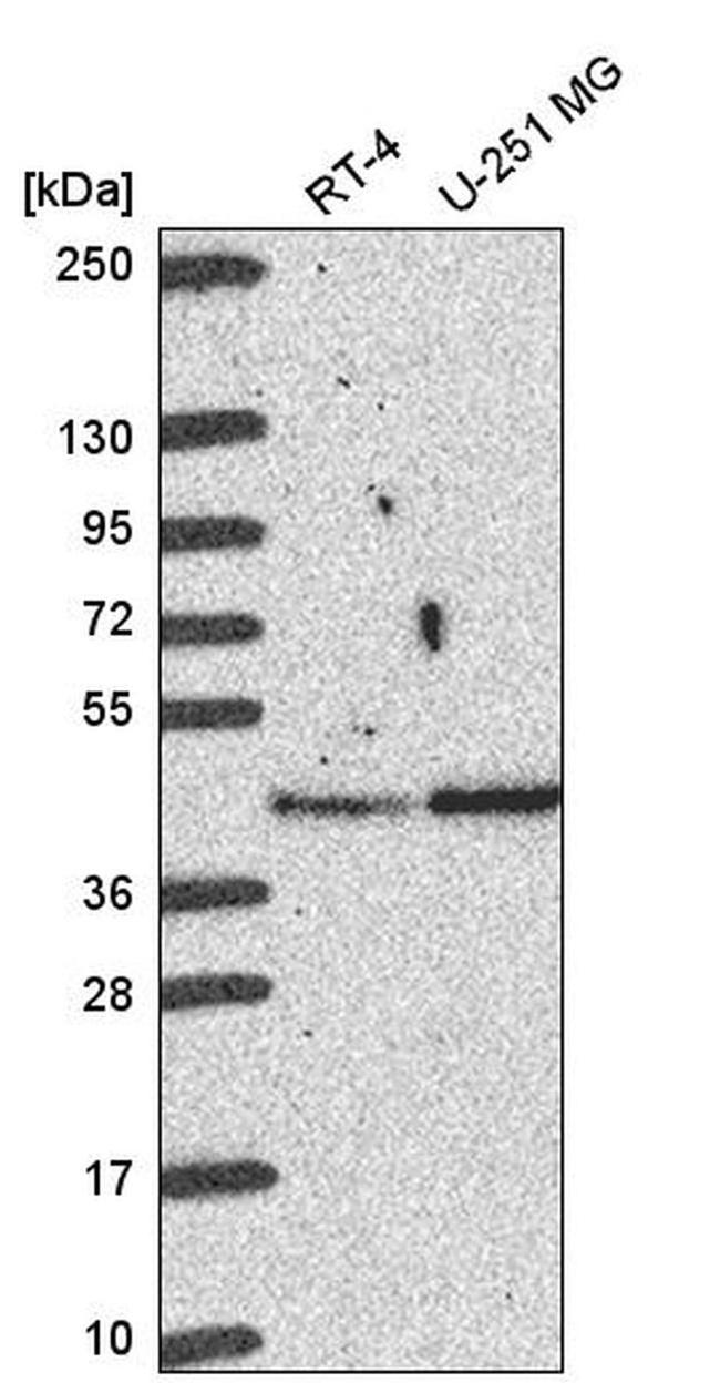 BABAM1 Antibody in Western Blot (WB)