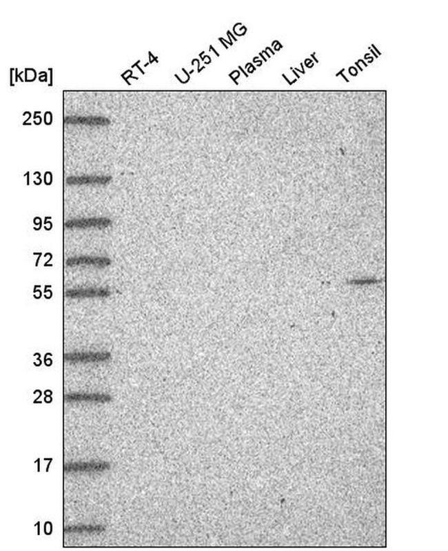 GLD2 Antibody in Western Blot (WB)