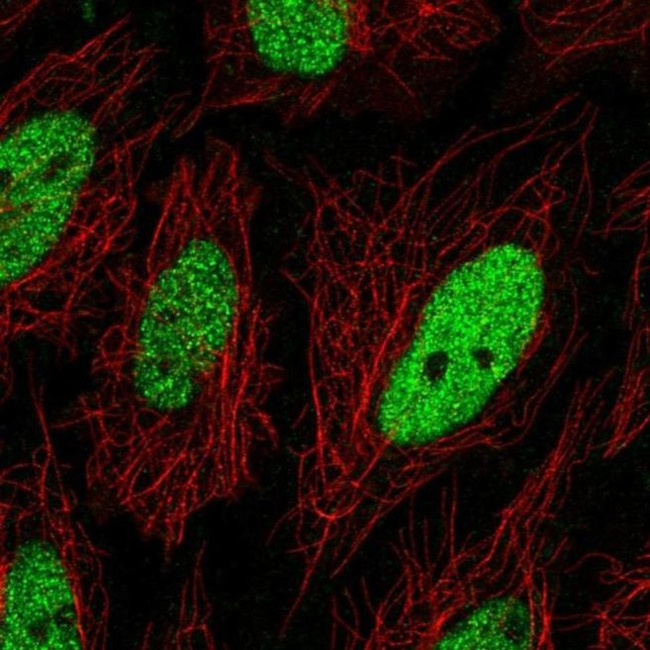 C19orf57 Antibody in Immunocytochemistry (ICC/IF)