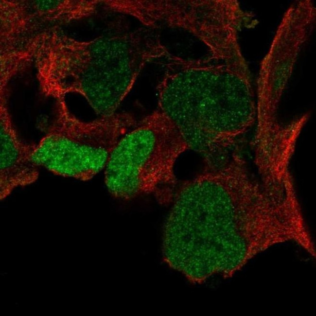 SOX3 Antibody in Immunocytochemistry (ICC/IF)