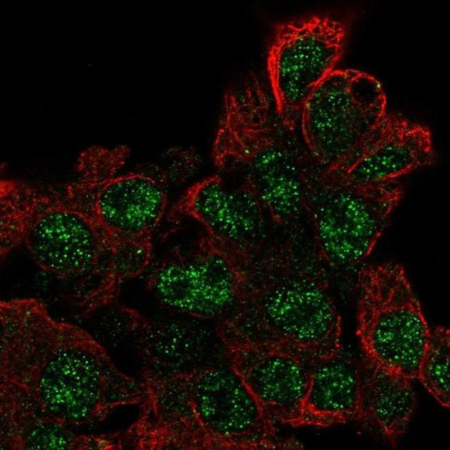 C17orf96 Antibody in Immunocytochemistry (ICC/IF)