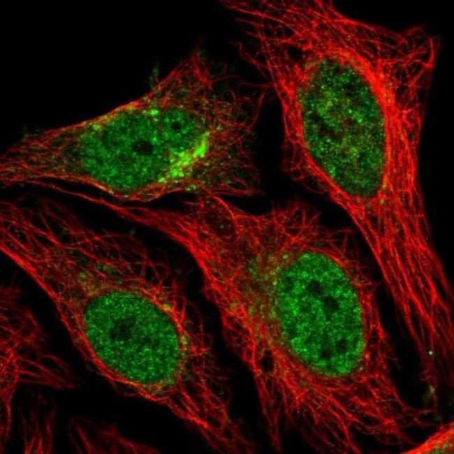 STX12 Antibody in Immunocytochemistry (ICC/IF)