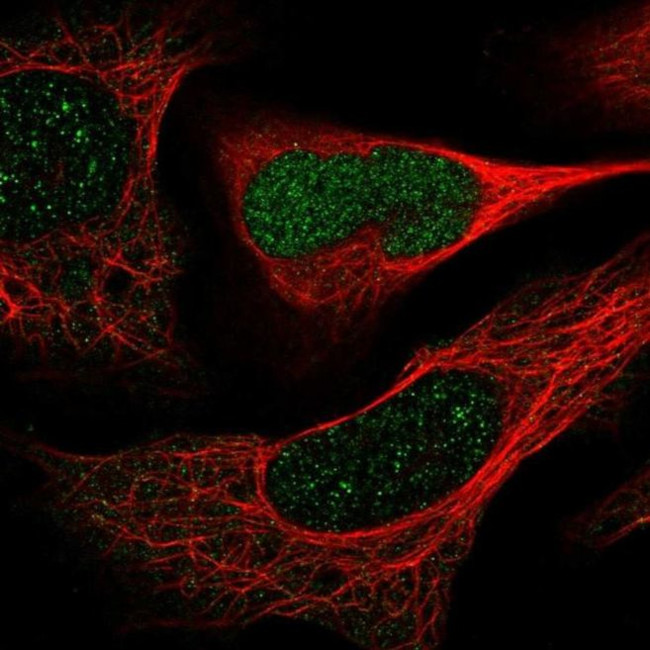 DERA Antibody in Immunocytochemistry (ICC/IF)