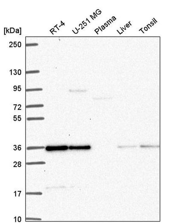 DERA Antibody in Western Blot (WB)