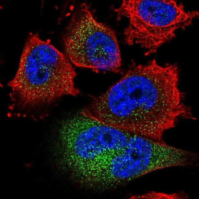 GOLT1B Antibody in Immunocytochemistry (ICC/IF)