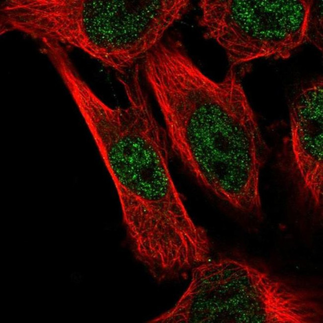 CAPZB Antibody in Immunocytochemistry (ICC/IF)