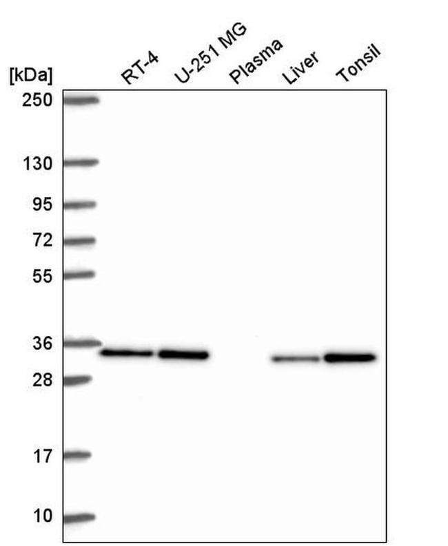 CAPZB Antibody in Western Blot (WB)