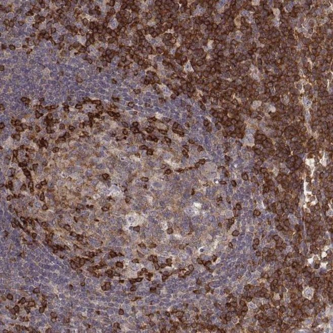 PILRA Antibody in Immunohistochemistry (IHC)