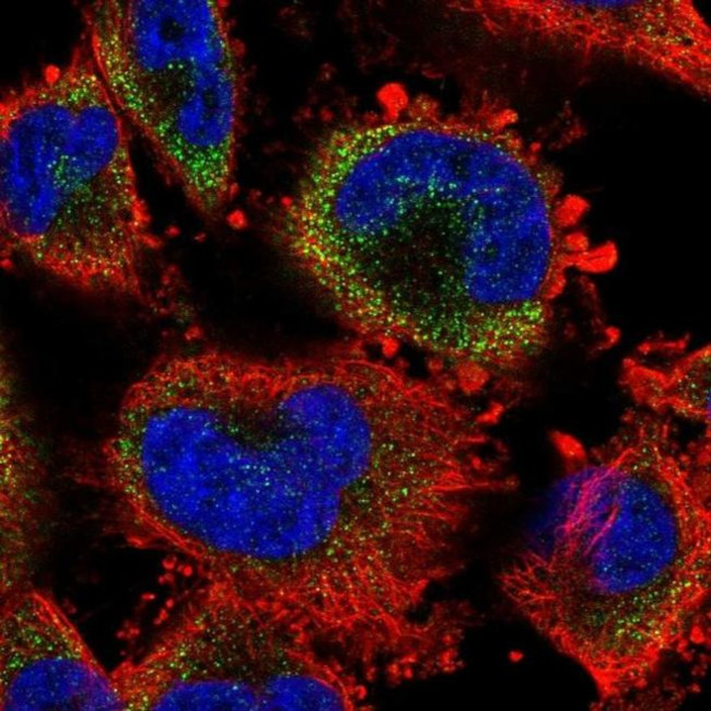 S100A3 Antibody in Immunocytochemistry (ICC/IF)