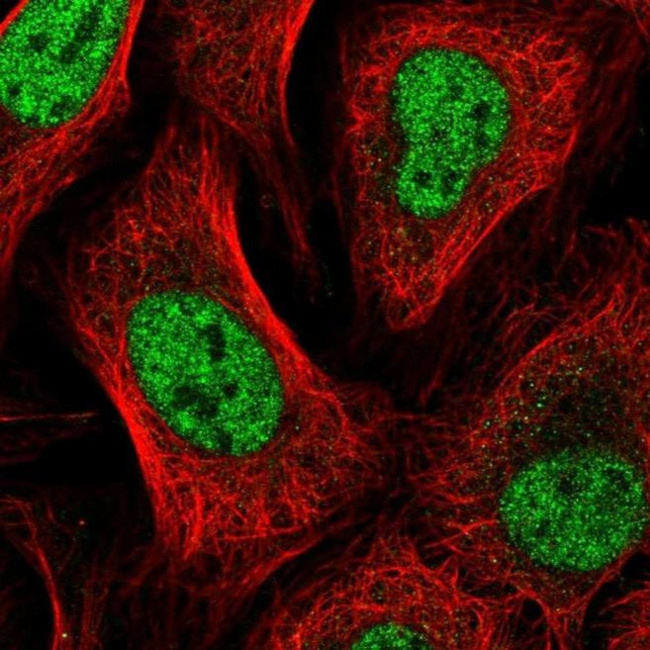 GTF2A2 Antibody in Immunocytochemistry (ICC/IF)