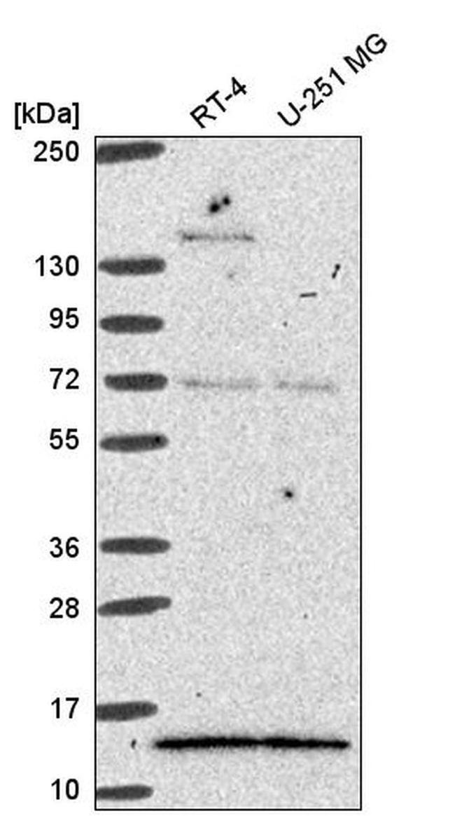 GTF2A2 Antibody in Western Blot (WB)