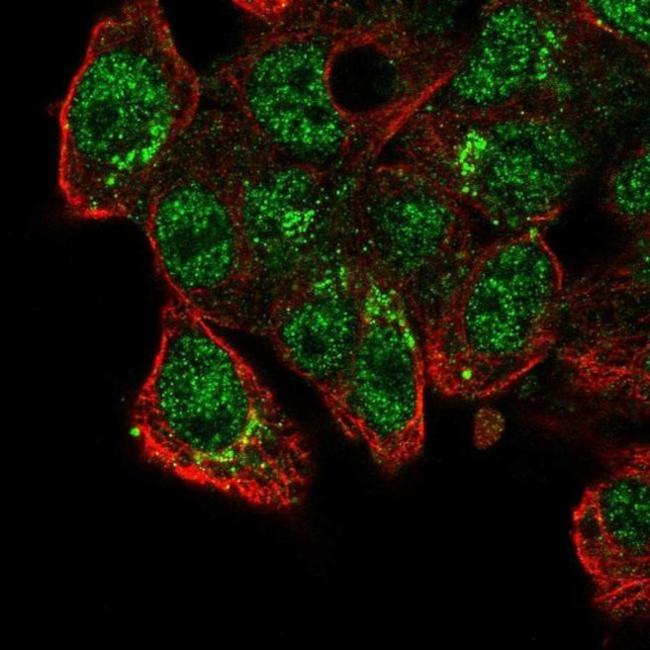 CADPS2 Antibody in Immunocytochemistry (ICC/IF)