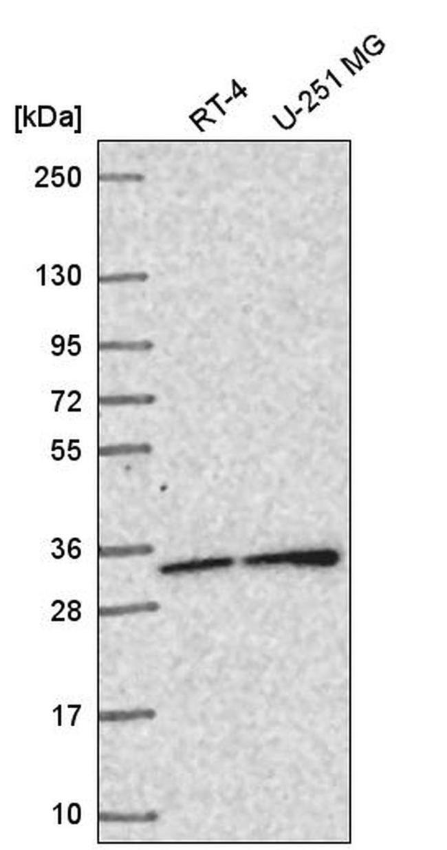 SNAP29 Antibody in Western Blot (WB)