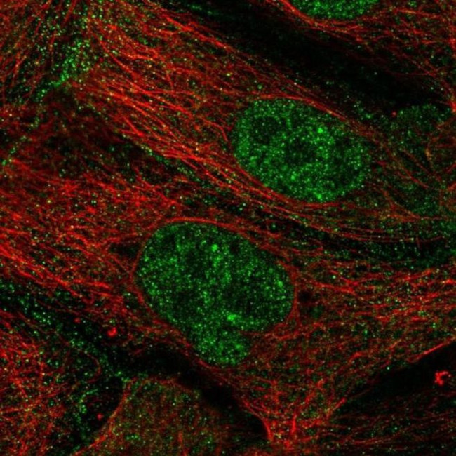 ZGPAT Antibody in Immunocytochemistry (ICC/IF)