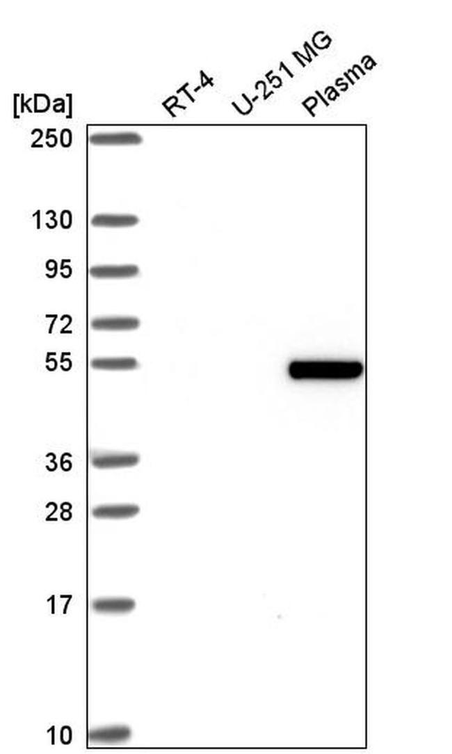 ZGPAT Antibody in Western Blot (WB)