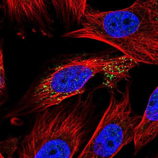 ABHD14A Antibody in Immunocytochemistry (ICC/IF)