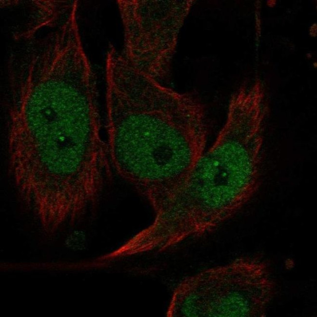 EVI2A Antibody in Immunocytochemistry (ICC/IF)