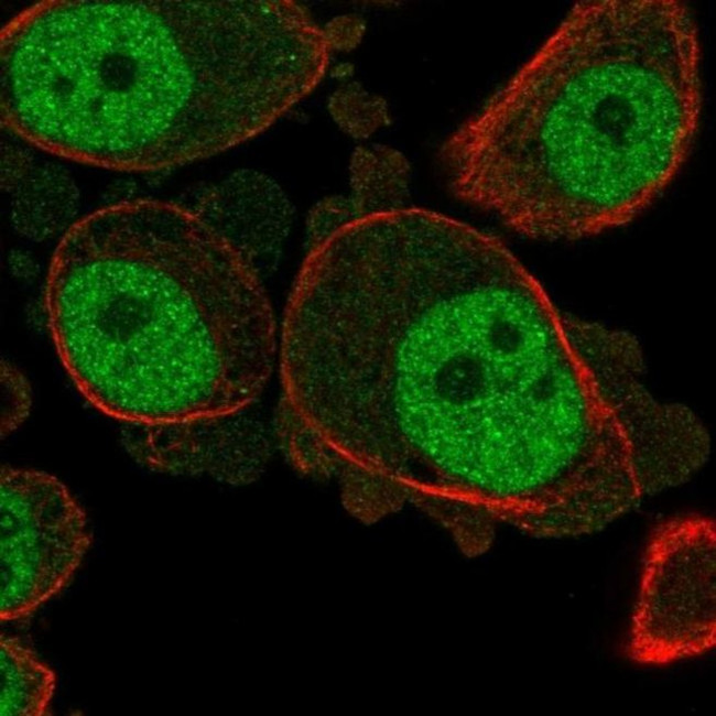 KCNN3 Antibody in Immunocytochemistry (ICC/IF)