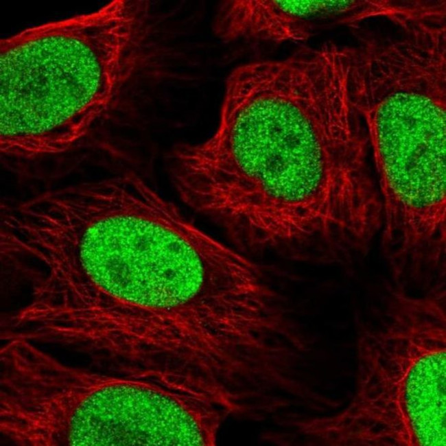 NAT9 Antibody in Immunocytochemistry (ICC/IF)