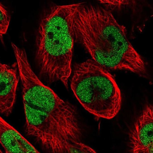 CAD Antibody in Immunocytochemistry (ICC/IF)