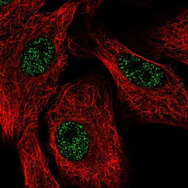 SETX Antibody in Immunocytochemistry (ICC/IF)