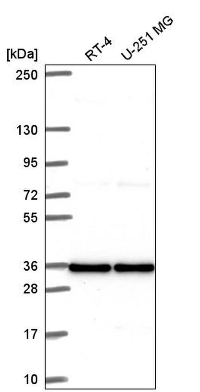 V-ATPase C1 Antibody in Western Blot (WB)