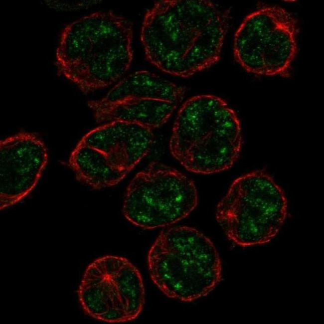 PCP2 Antibody in Immunocytochemistry (ICC/IF)