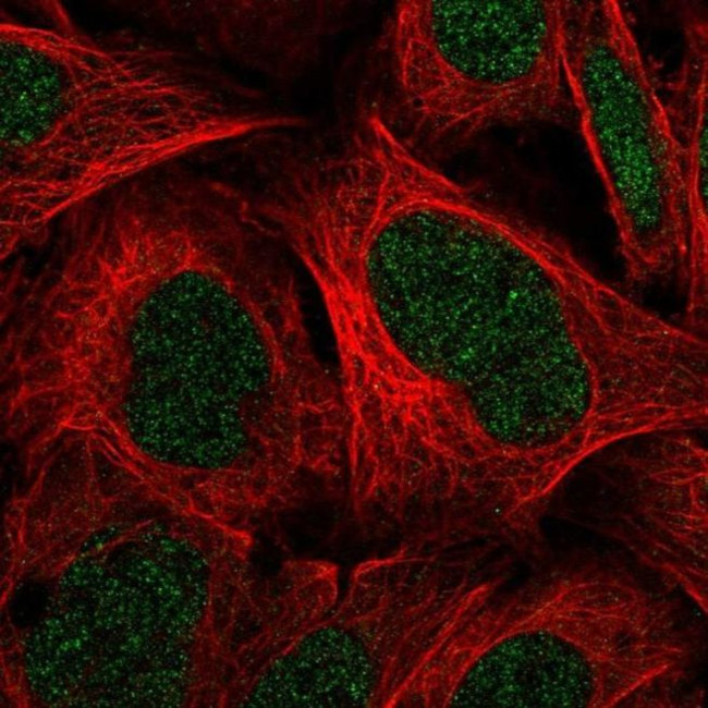 C11orf1 Antibody in Immunocytochemistry (ICC/IF)