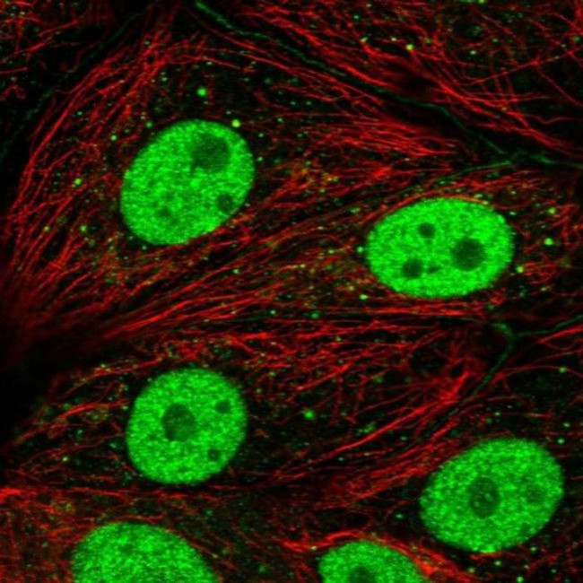 DCP2 Antibody in Immunocytochemistry (ICC/IF)