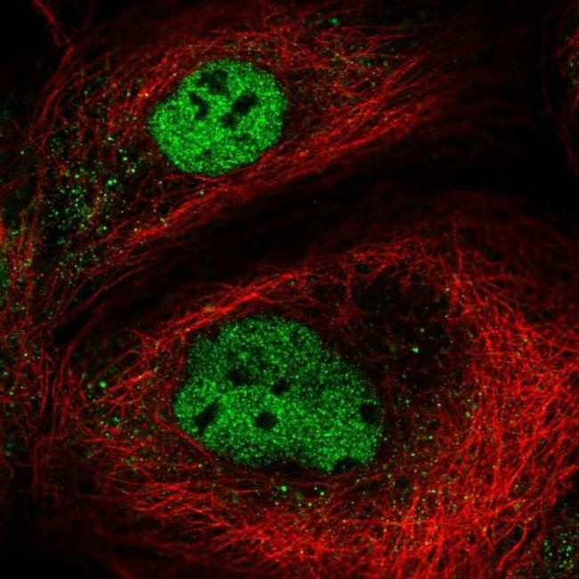 NEMP2 Antibody in Immunocytochemistry (ICC/IF)