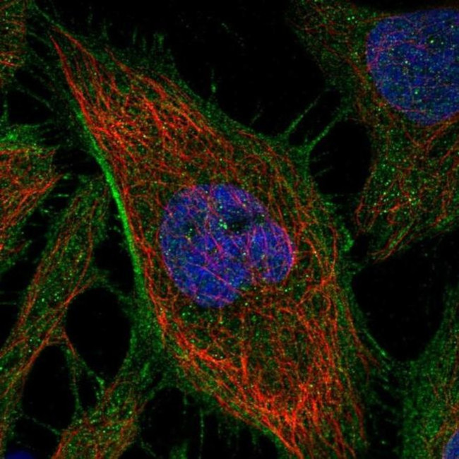 ARHGAP21 Antibody in Immunocytochemistry (ICC/IF)