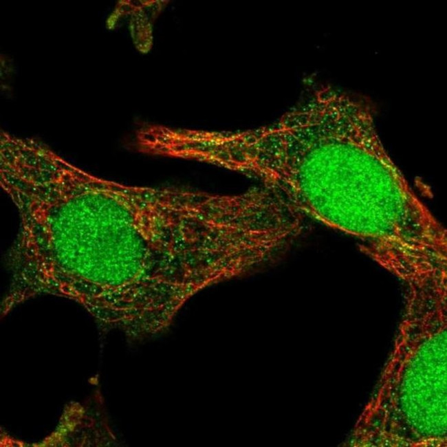 SOCS4 Antibody in Immunocytochemistry (ICC/IF)