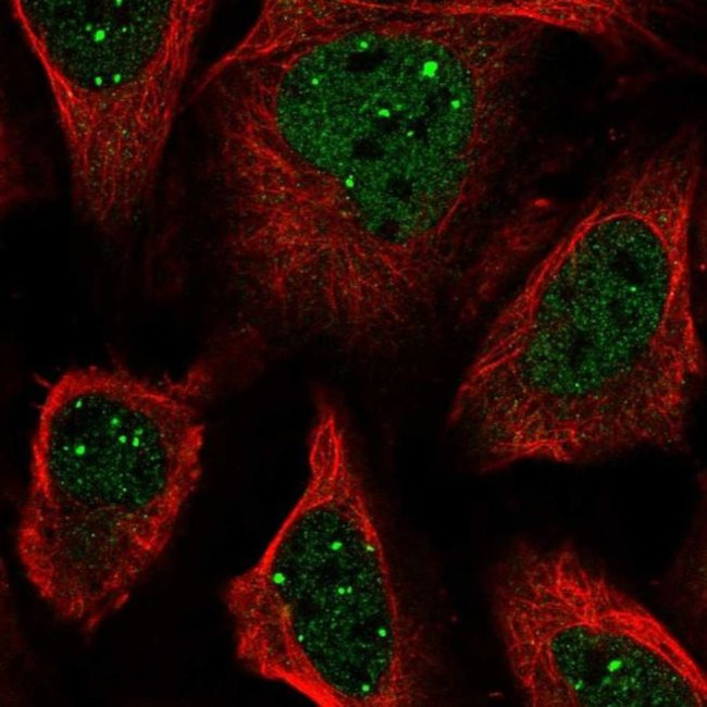 SAB Antibody in Immunocytochemistry (ICC/IF)