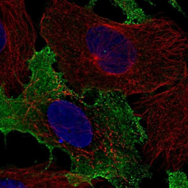 NKG2C Antibody in Immunocytochemistry (ICC/IF)