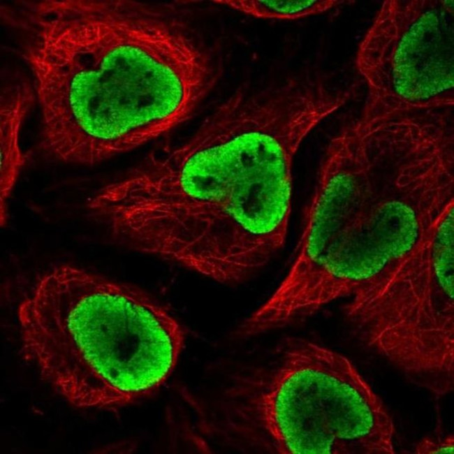 NUP54 Antibody in Immunocytochemistry (ICC/IF)