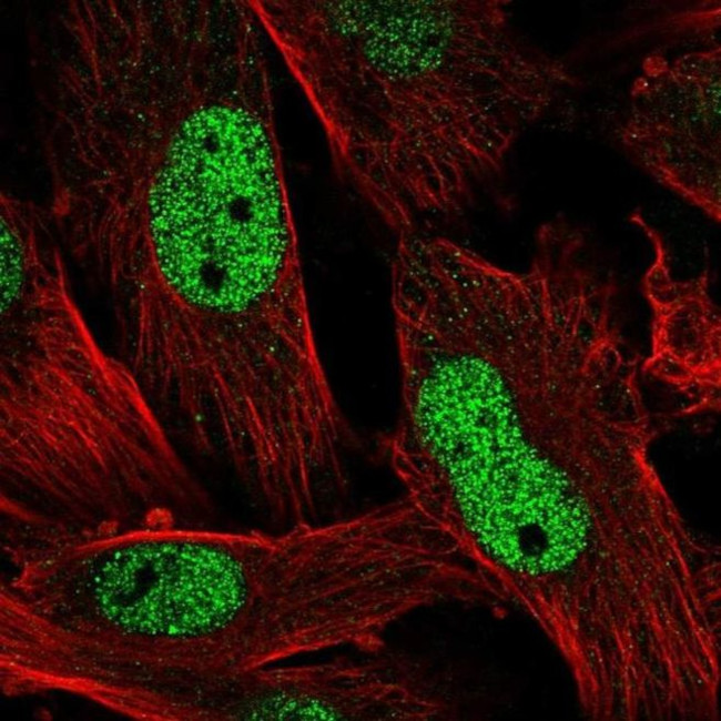 EMP Antibody in Immunocytochemistry (ICC/IF)