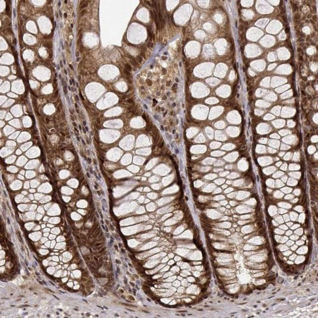 EMP Antibody in Immunohistochemistry (IHC)