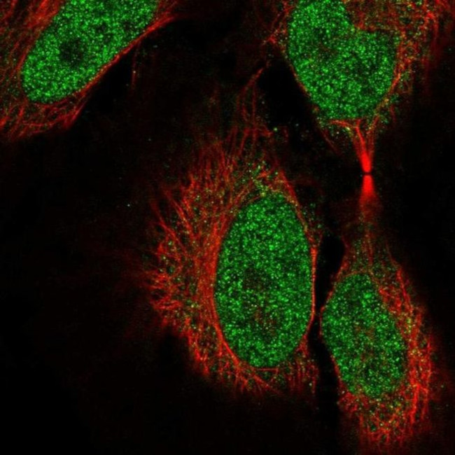 COL9A3 Antibody in Immunocytochemistry (ICC/IF)