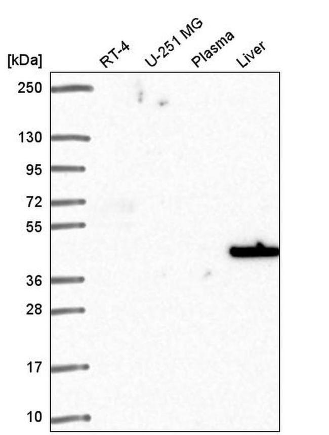 SLC14A1 Antibody in Western Blot (WB)