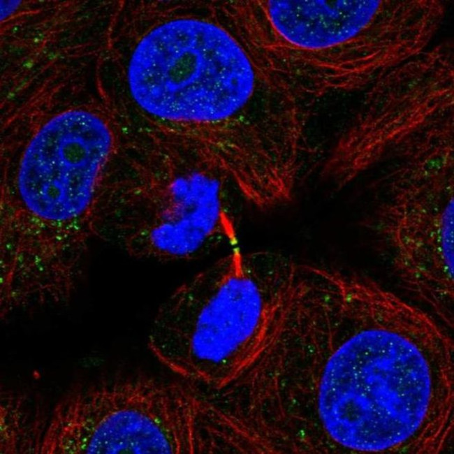 ADAMTS19 Antibody in Immunocytochemistry (ICC/IF)