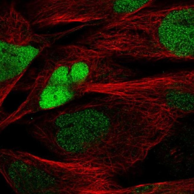 SOX8 Antibody in Immunocytochemistry (ICC/IF)