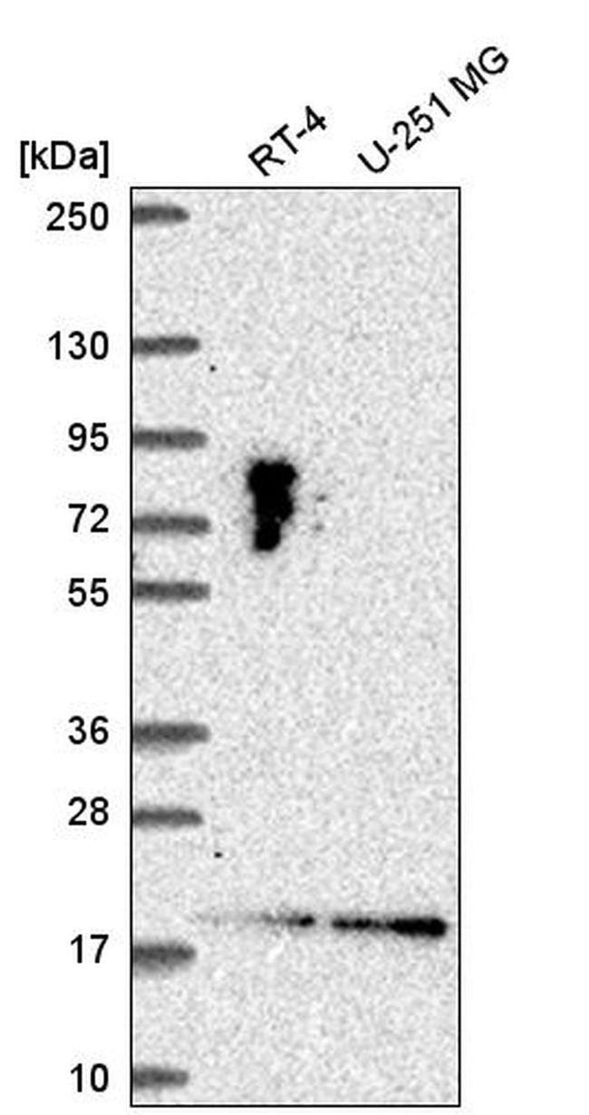 LLPH Antibody in Western Blot (WB)