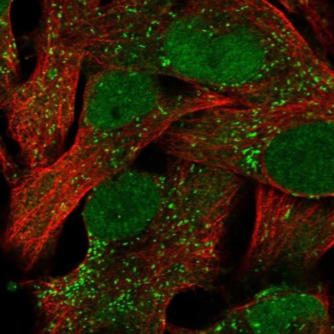 ACSBG1 Antibody in Immunocytochemistry (ICC/IF)