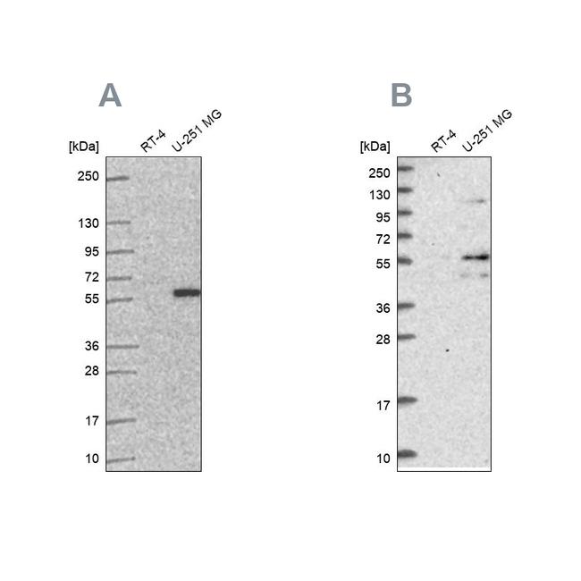 ACSBG1 Antibody in Western Blot (WB)