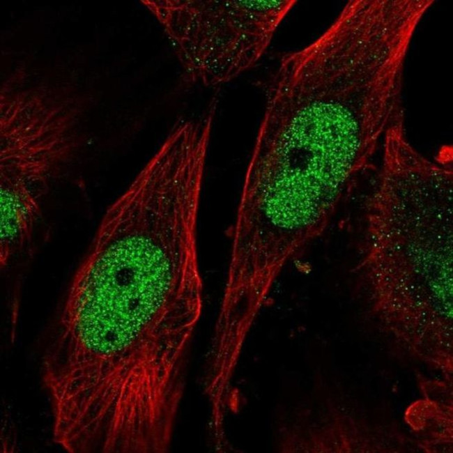 SAP30 Antibody in Immunocytochemistry (ICC/IF)