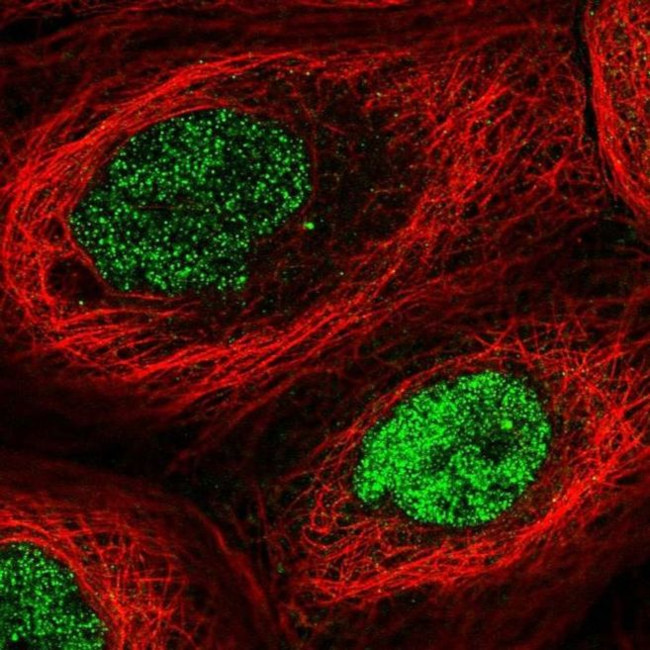 N6AMT1 Antibody in Immunocytochemistry (ICC/IF)