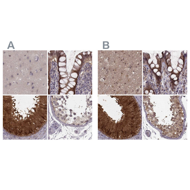 GSS Antibody in Immunohistochemistry (IHC)