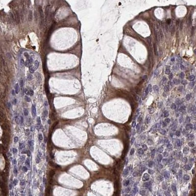 GSS Antibody in Immunohistochemistry (IHC)