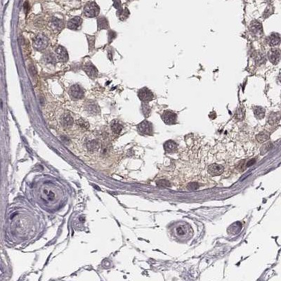 GSS Antibody in Immunohistochemistry (IHC)